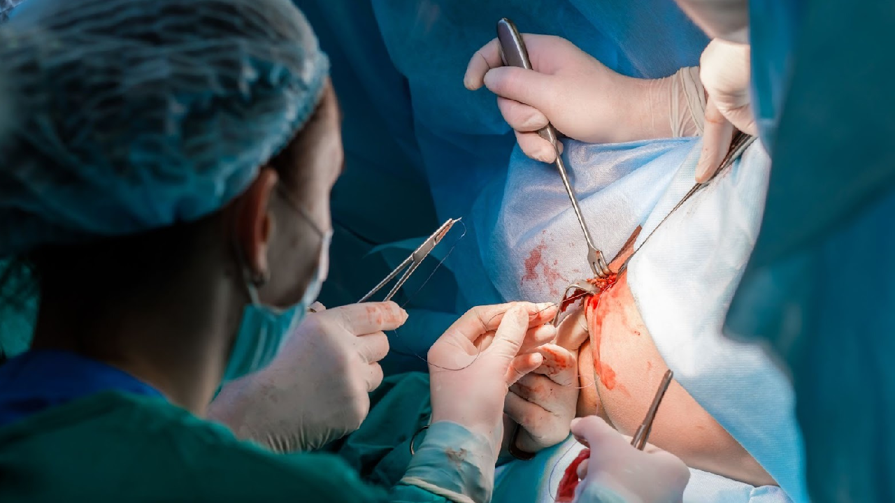 jaundice-treatment-in-coimbatore-chennai