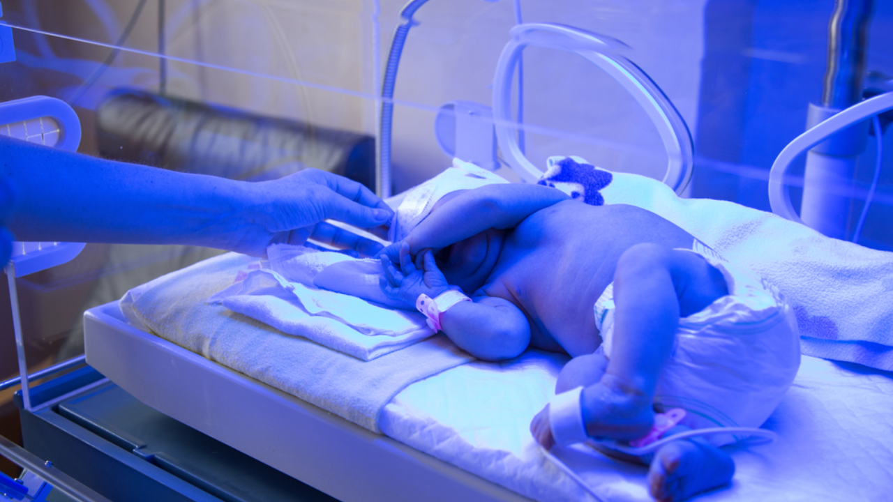 neonatal-jaundice