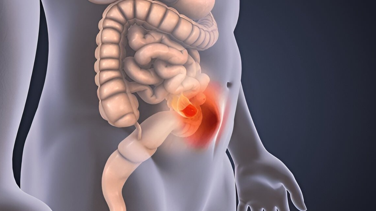 jaundice-treatment-in-coimbatore-chennai