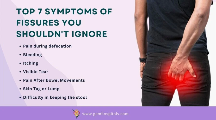 Top 7 Symptoms of Fissures You Shouldn't Ignore