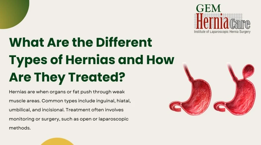 What Are the Different Types of Hernias and How Are They Treated?