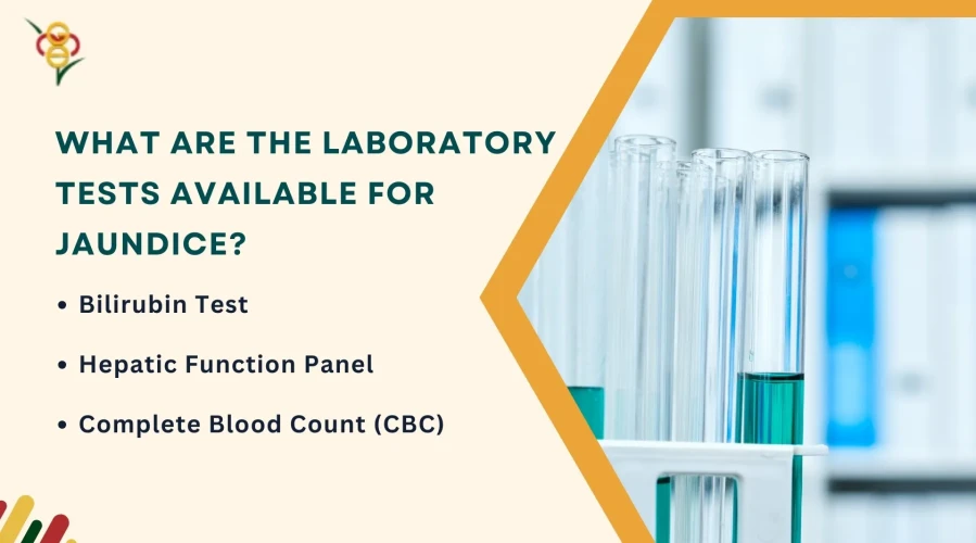 What Are the Laboratory Tests Available for Jaundice?