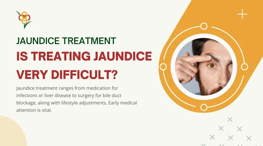 Is treating jaundice very difficult?
