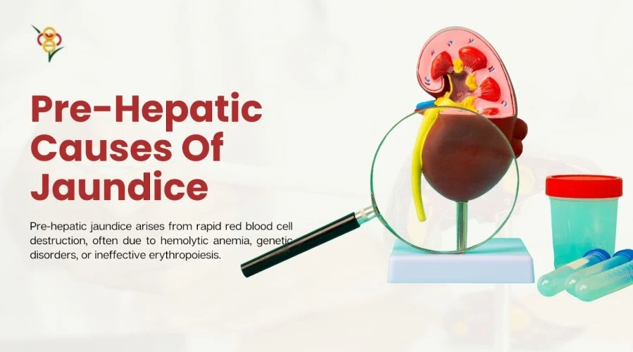 What are the pre-hepatic causes of jaundice