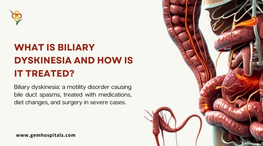 What Is Biliary Dyskinesia and How Is It Treated?