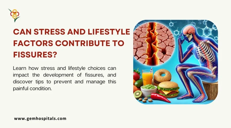 Can Stress and Lifestyle Factors Contribute to Fissures?