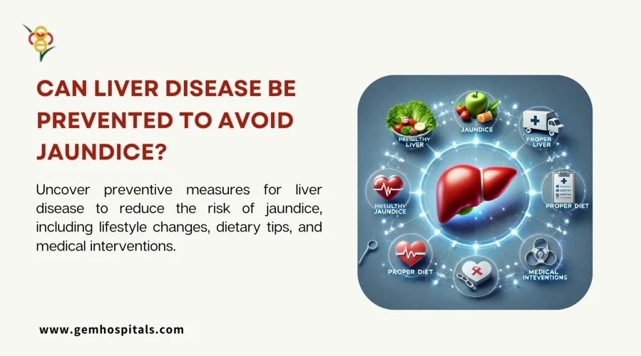 Can Liver Disease Be Prevented to Avoid Jaundice?