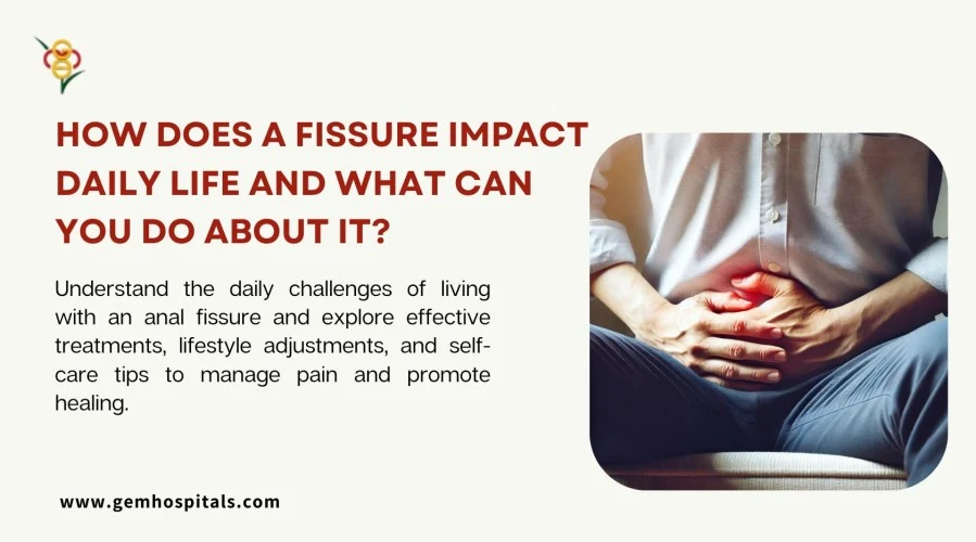 How Does a Fissure Impact Daily Life and What Can You Do About It?