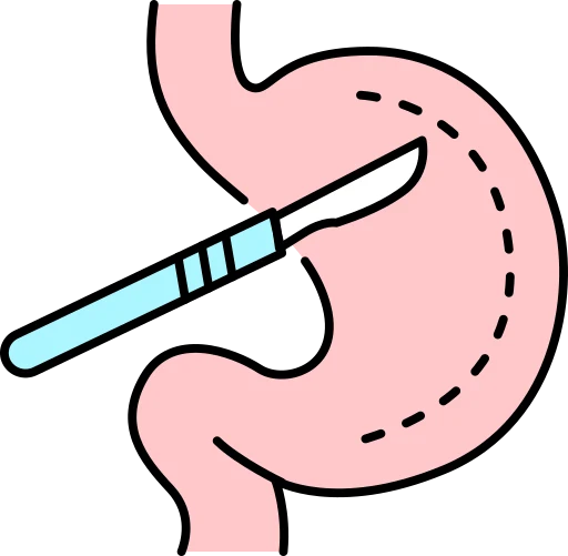 HPB Surgery