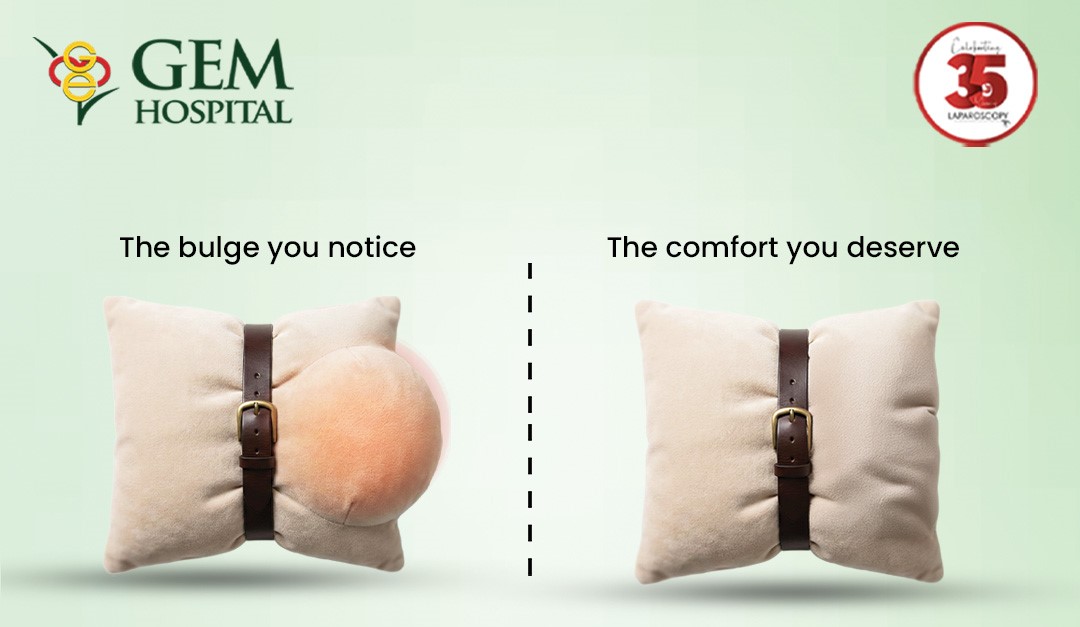 Doctor explaining e-TEP hernia repair