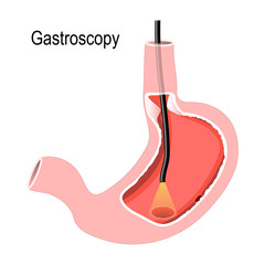 surgery