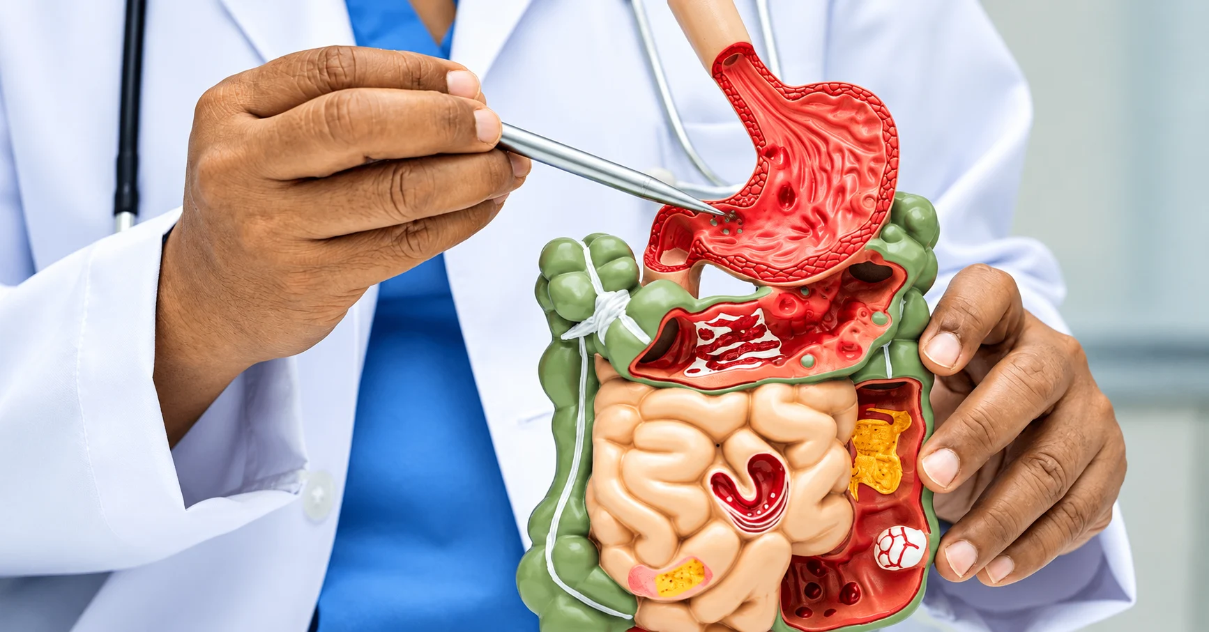 Gastrointestinal Oncology at GEM Hospital