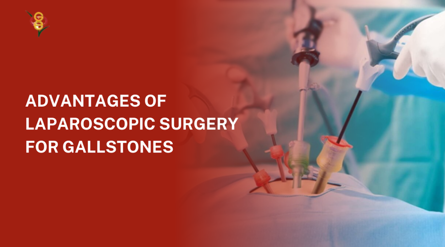 Top Advantages of Laparoscopic Surgery for Gallstones