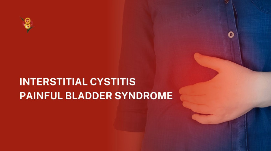 Interstitial Cystitis: Understanding Painful Bladder Syndrome