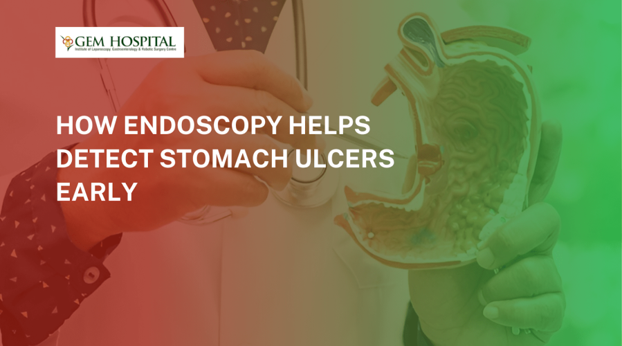 How Endoscopy Helps Detect Stomach Ulcers Early