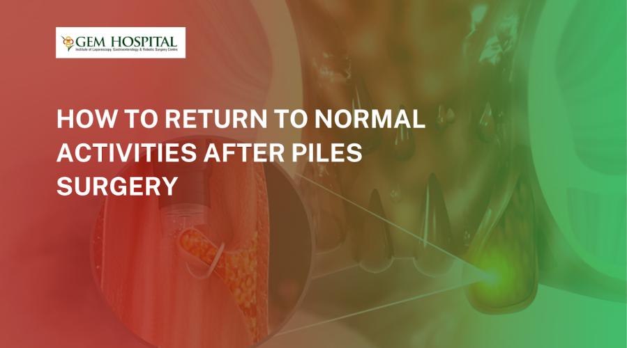 How to Return to Normal Activities After Piles Surgery