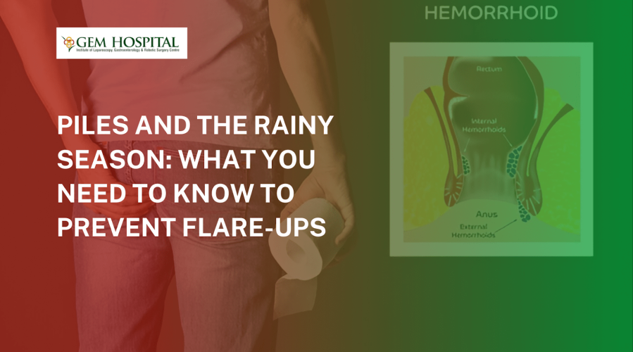 Piles and the Rainy Season: What You Need to Know to Prevent Flare-Ups