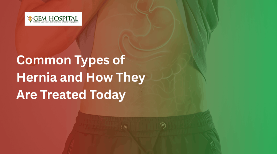 Common Types of Hernia and How They Are Treated Today