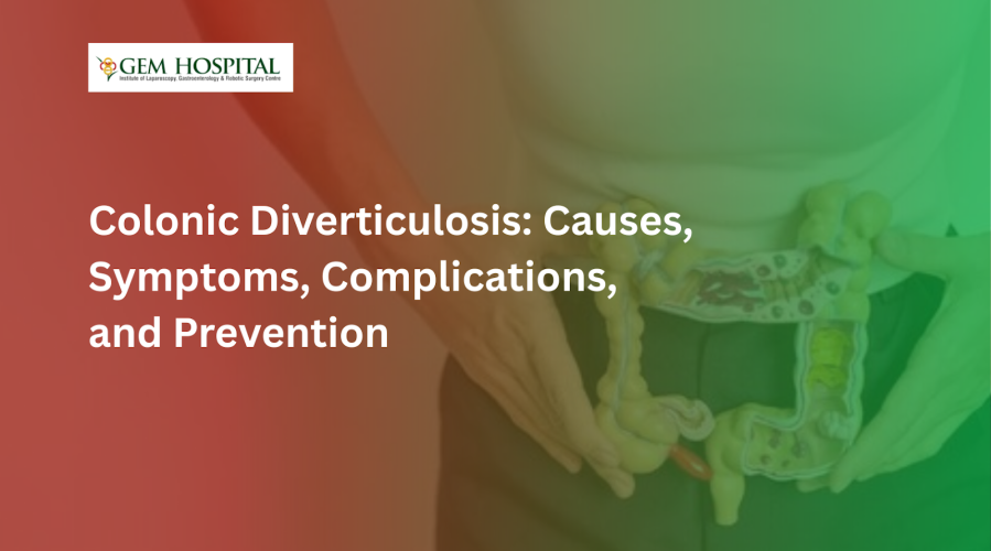 Colonic Diverticulosis Causes, Symptoms, Complications, and Prevention