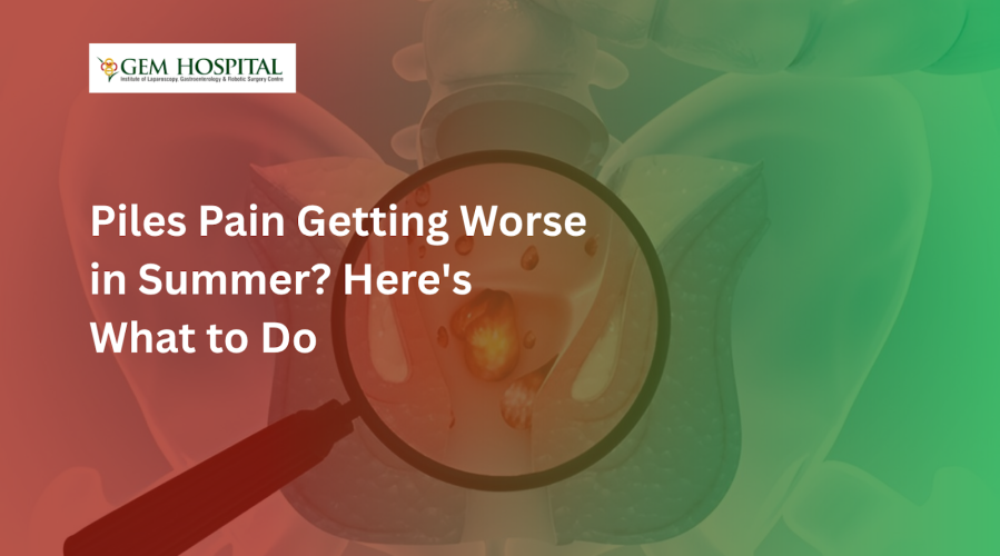Piles Pain Getting Worse in Summer? Here's What to Do