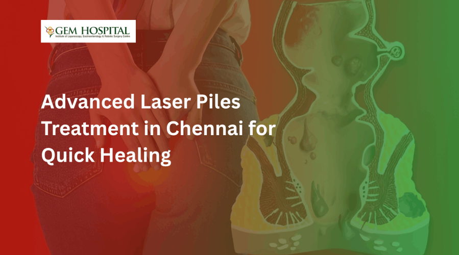 Advanced Laser Piles Treatment in Chennai for Quick Healing