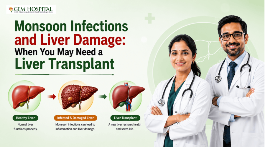 Monsoon Infections and Liver Damage: When You May Need a Liver Transplant